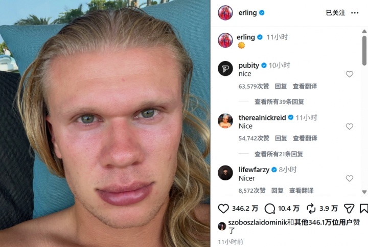 哈兰德社媒晒度假自拍：躺椅＋太阳，冲击力依旧